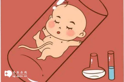 做四维彩超的时间没预想中的长，用对方法后所需时间还可降低